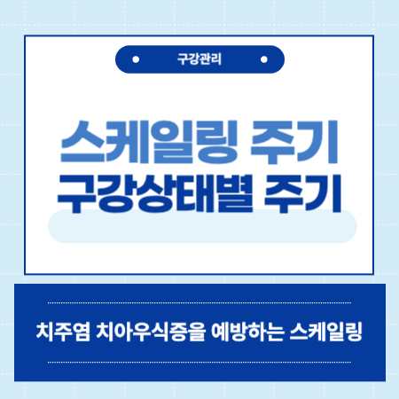 스케일링 주기 알아보기